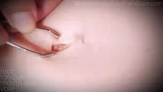 Redare Examenul de eliberare a abdomenului separat 1